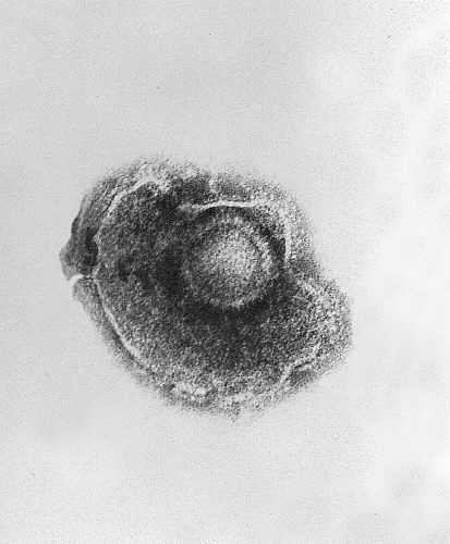 The Varicella virus